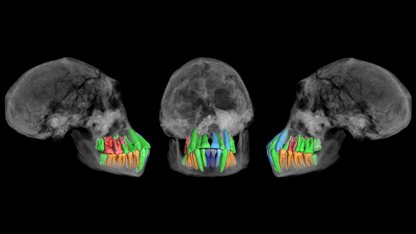 Fossil teeth hint at a surprisingly early start to humans’ long childhoods